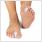 Zehen Spreizer Hallux Valgus