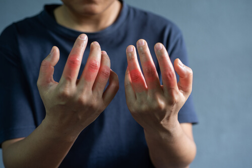 die ersten symptoms von rheuma