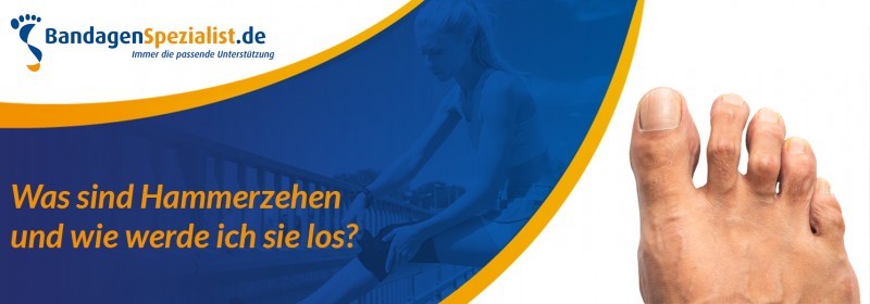 Was sind hammerzehen und wie werede ich sie los